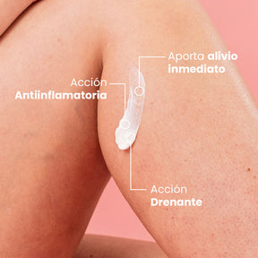 Crema para Varices y Arañas Capilares